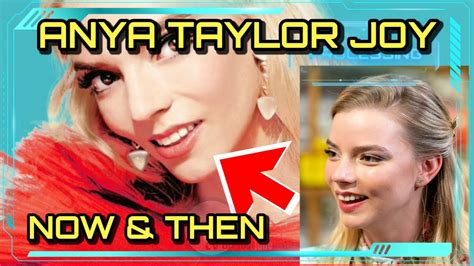 anya taylor-joy teeth|Anya Taylor Joy before surgeries : r/trueratecelebrities。